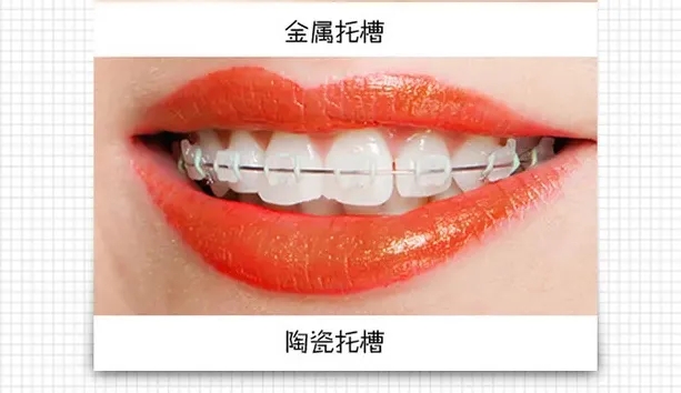 7.webp.jpg