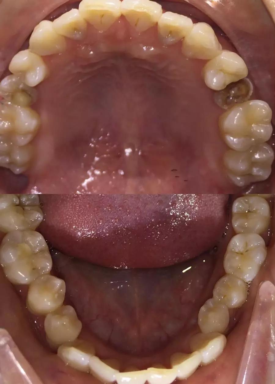 渡江口腔优秀病例展示 地包天牙齿矫正-最新文章-活动